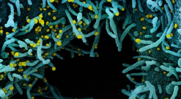 Novo SARS-CoV-2 de Coronavírus Micrografia eletrônica de varredura colorida de uma célula fortemente infectada com partículas do vírus SARS-CoV-2 (amarelo), isoladas de uma amostra de paciente. A área preta da imagem é espaço extracelular entre as células. Imagem capturada no NIAID Integrated Research Facility (IRF) em Fort Detrick, Maryland. Foto: NIAID/via Fotos Públicas.