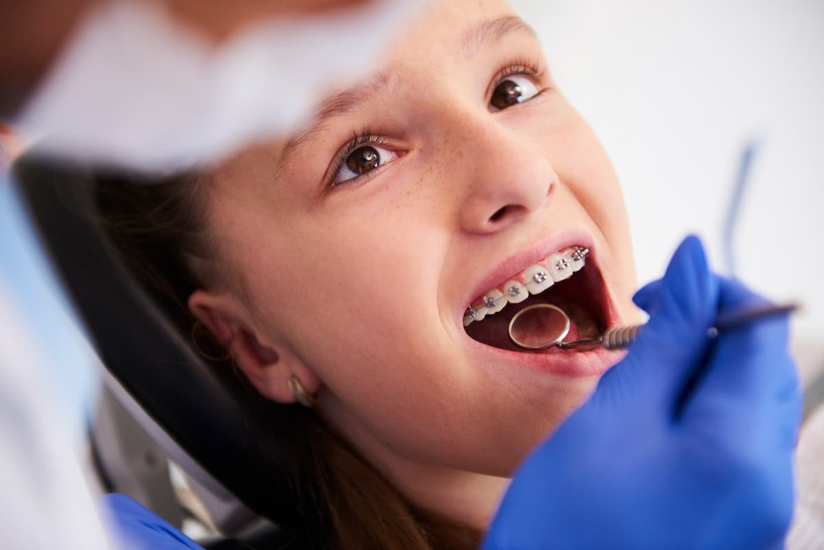 Saiba como cuidar dos dentes depois de tirar o aparelho. Foto: Criança foto criado por gpointstudio - br.freepik.com.